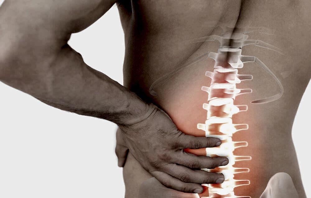 Ameliyatsız Bel-Boyun Fıtığı Tedavisi